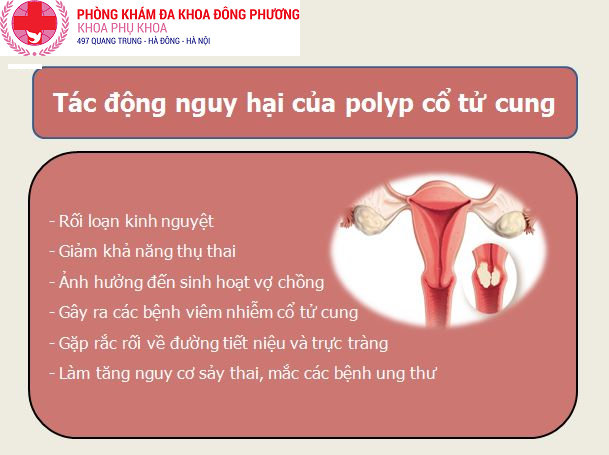 Triệu chứng nhận biết bệnh polyp cổ tử cung