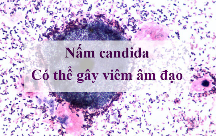 Nam-Candida-co-the-gay-viem-am-dao