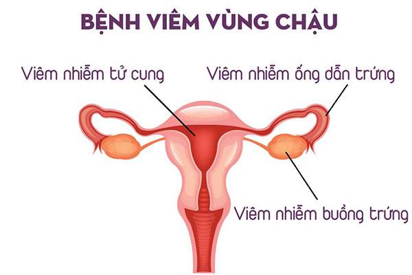 Viem Vung Chau