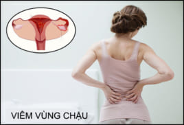 Viem Vung Chau (1)